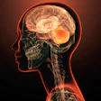 Medical illustration of human head showing brain, skull, and nervous system with glowing orange highlights on dark background