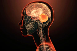 Medical illustration of human head showing brain, skull, and nervous system with glowing orange highlights on dark background
