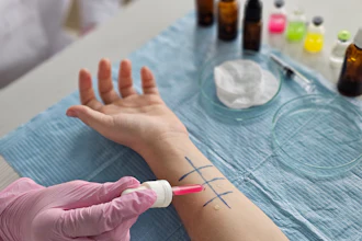 Allergy skin prick test being performed on patient's arm with testing vials and materials visible