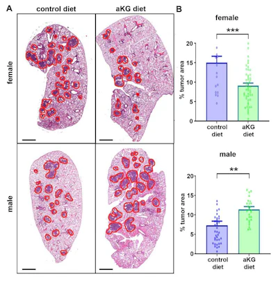 Histopathology comparison of tumor tissue in female and male mice on control and aKG diets with quantified tumor area percentages