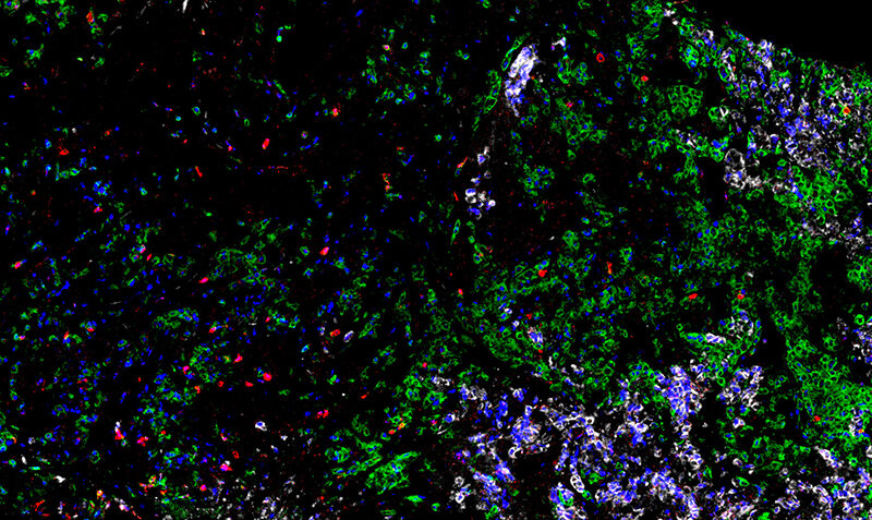 Fluorescent microscopy image showing multi-colored biological particles and cellular structures with green, blue, purple, and red fluorescent markers on black background