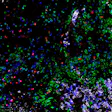 Fluorescent microscopy image showing multi-colored biological particles and cellular structures with green, blue, purple, and red fluorescent markers on black background