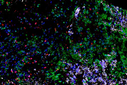 Fluorescent microscopy image showing multi-colored biological particles and cellular structures with green, blue, purple, and red fluorescent markers on black background