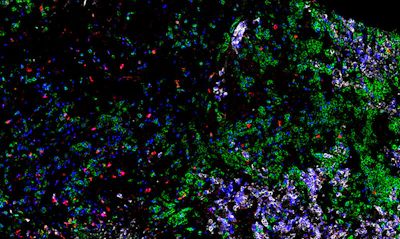 Fluorescent microscopy image showing multi-colored biological particles and cellular structures with green, blue, purple, and red fluorescent markers on black background